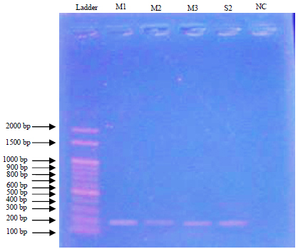 Image for - Characterization and Confirmation of Lactobacillus spp. from Selective Regional Yoghurts for Probiotic and Interference with Pathogenic Bacterial Growth