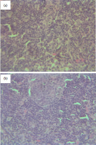 Image for - Interaction Between Myrrh and Glibenclamide on Organ Damage in Diabetic Rats, a Morphological Study