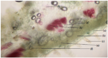 Image for - Pharmacognostical, Antibacterial and Antioxidant Studies of Aerial Parts of Pulicaria somalensis (Family: Asteraceae)
