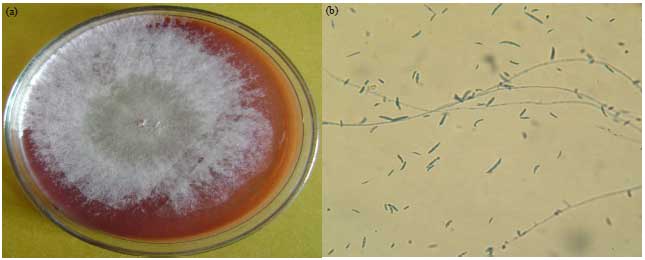 Image for - Occurrence and Prevalence of Mycotoxigenic Fusarium solani in Onion Samples Collected from Different Regions of Libya