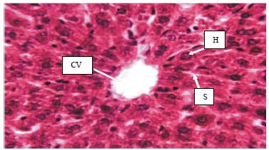 Image for - Effects of Fermented Parkia biglobosa Seeds at Varied Dietary Inclusion on Liver Function of Albino Wistar Rat