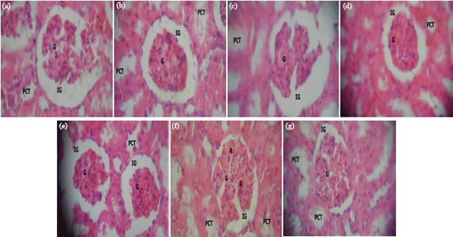 Image for - Chemoprotective Potentials of Selected Dietary Supplements inGlyphosate-based Herbicide-induced Nephrotoxicity andDyslipidemia in Albino Wistar Rats