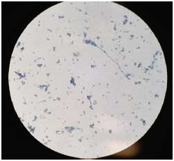 Image for - Prevalence of Dermatophytic fungi in Cats of Shah Alam, Selangor, Malaysia