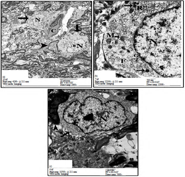 Image for - Histochemical, Immunohistochemical and Ultrastructural Identification and Characterization of Neurosecretory Cells of Pineal Gland