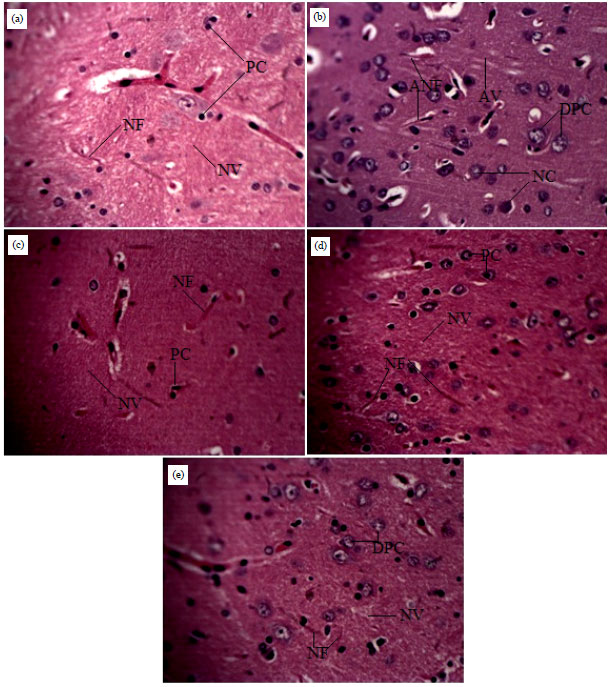 Image for - Neuroprotective Potential of Swietenia macrophylla Seed Extract in Lead-induced Neurodegeneration in Albino Rats