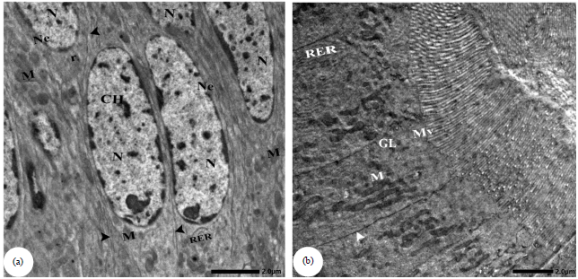 Image for - Histological and Ultrastructure Alterations in the Midgut of Blaps polycresta and Trachyderma hispida (Coleoptera: Tenebrionidae) Induced by Heavy Metals Pollution