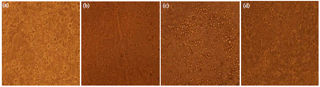 Image for - Evaluation of Antiviral Efficacy of Punica granatum L. on Human Herpes Virus-3 (Varicella Zoster Virus)