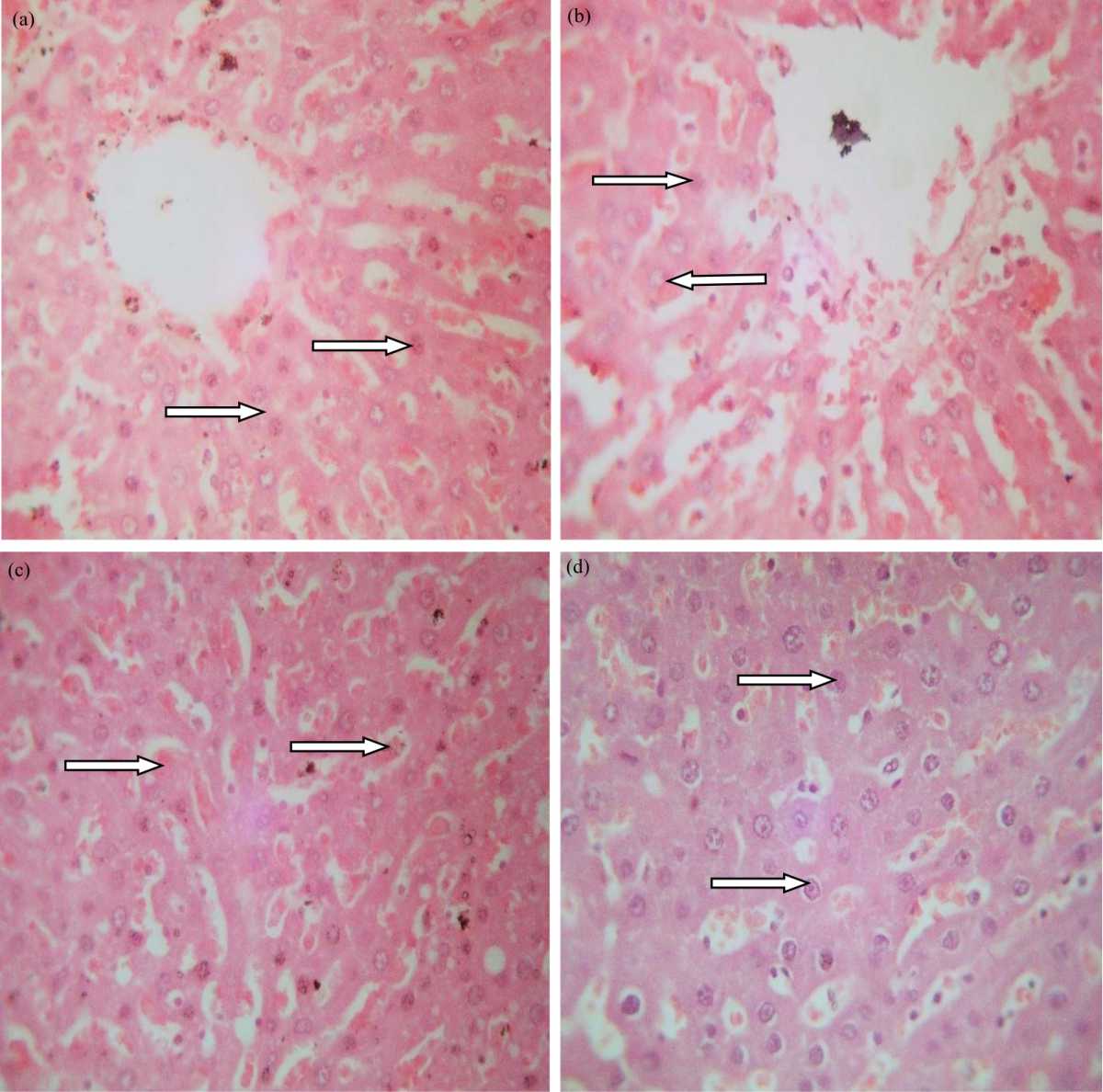 Image for - Ethanolic Leaf Extract of Ocimum gratissimum Abrogates Methotrexate-induced Liver Injury in Albino Rats