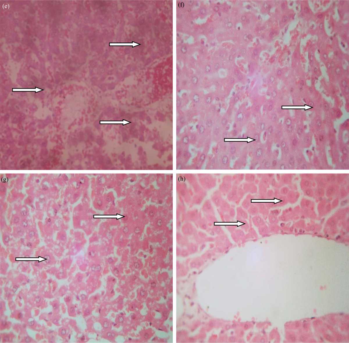 Image for - Ethanolic Leaf Extract of Ocimum gratissimum Abrogates Methotrexate-induced Liver Injury in Albino Rats