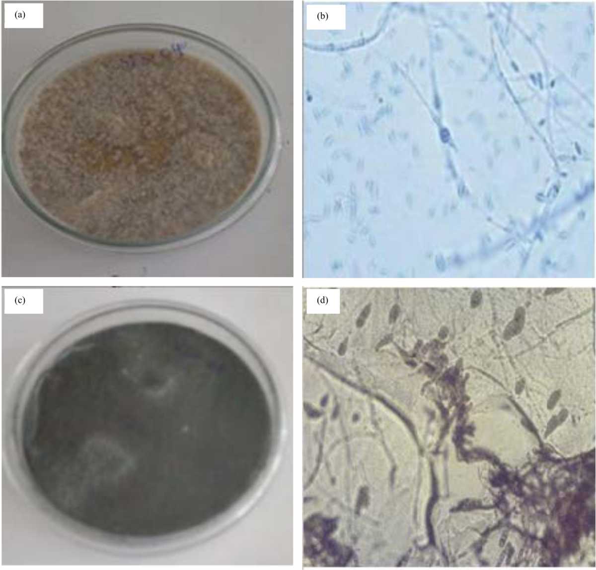 Image for - Antifungal Activity Evaluation of Trichoderma Species Against Fusarium Wilt and Alternaria Leaf Blight of Sesame (Sesame indicum L.) Under in vitro Conditions