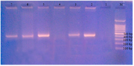 Image for - Effect of Pesticide(s) Carryover on Results of Polymerase Chain Reaction  and Multiplex-PCR for Diagnosis of Potato Bacterial Pathogens