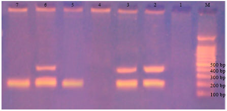 Image for - Effect of Pesticide(s) Carryover on Results of Polymerase Chain Reaction  and Multiplex-PCR for Diagnosis of Potato Bacterial Pathogens