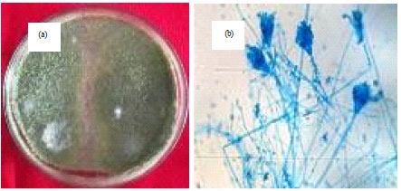 Image for - Isolation, Identification and in vitro Screening of Rhizospheric Fungi for Biological Control of Macrophomina phaseolina