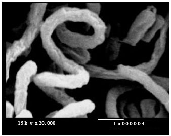Image for - Biosynthesis of Hygromycin-B Antibiotic by Streptomyces crystallinus AZ151 Isolated from Assuit, Egypt