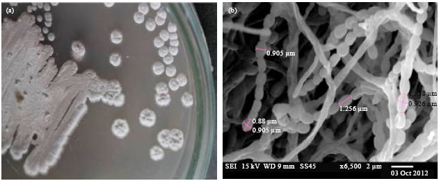 Image for - Molecular Characterization of Marine Streptomyces enissocaesilis Capable of L-asparaginase Production