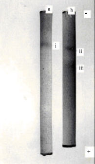 Image for - Purification and Characterization of Fruit Bat (Eidolon helvum, Kerr) Liver Arginase