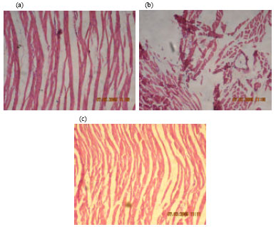 Image for - Co-Enzyme Q10 Protects Rat Heart against Oxidative Stress Induced by Ischemic Reperfusion Injury