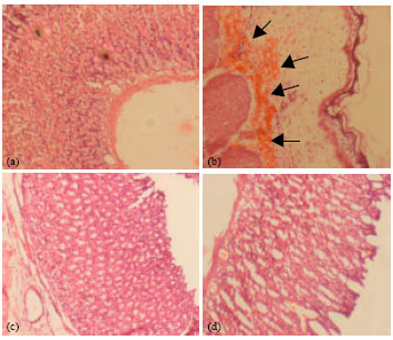 Image for - Supplementation of Betaine Attenuates HCl-Ethanol Induced Gastric Ulcer in Rats