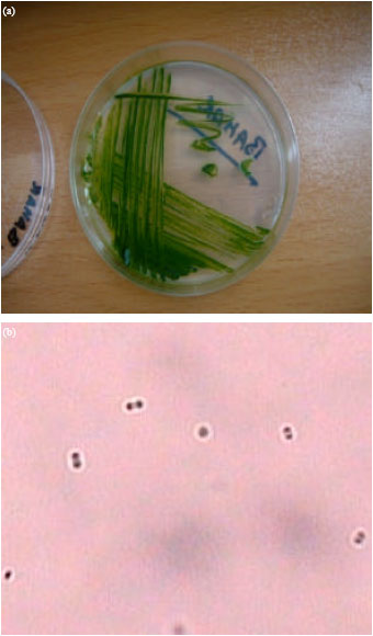 Image for - Analysis of Cyanide Bioremediation Using Cyanobacterium; Chroococcus  Isolated from Steel Manufacturing Industrial Wastewater