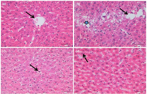 Image for - Influence of Dietary Supplementation of Fenugreek (Trigonella foenum-graecum L.) on Serum Biochemical Parameters of Rats Fed High Cholesterol Diet