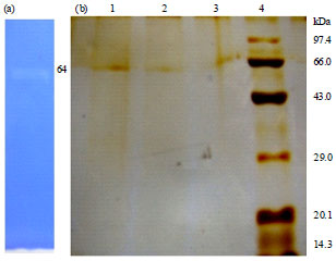 Image for - Purification and Characterization of Fibrinolytic Enzyme from Pseudoalteromonas sp., IND11 and its in vitro Activity on Blood Clot