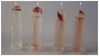 Image for - Purification and Characterization of Fibrinolytic Enzyme from Pseudoalteromonas sp., IND11 and its in vitro Activity on Blood Clot