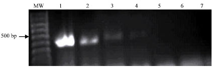 Image for - Evaluation of Polymerase Chain Reaction for Direct Detection of Escherichia coli Strains in Environmental Samples

