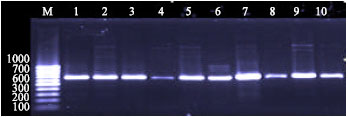 Image for - Development of Polymerase Chain Reaction and Dot Blot Hybridization to Detect Escherichia coli Isolates from Various Sources