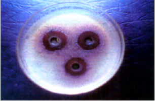 Image for - In vitro Anti-Microbial Activity of Psidium guajava Extracts