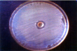 Image for - In vitro Anti-Microbial Activity of Psidium guajava Extracts