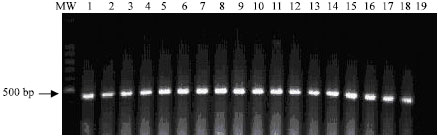 Image for - Evaluation of Polymerase Chain Reaction for Direct Detection of Escherichia coli Strains in Environmental Samples
