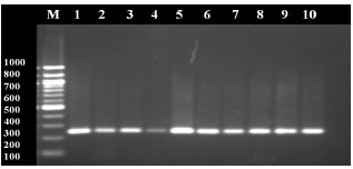 Image for - Detection of Diarrheagenic Escherichia coli Isolated Using Molecular Approaches