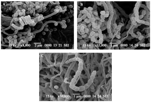 Image for - Isolation and Identification of Biosurfactant Producing Actinomycetes From Soil