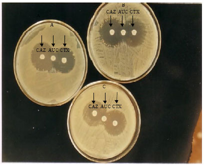 Image for - Characterisation of Extended Spectrum Beta-Lactamase Producing E. coli from Secondary and Tertiary Hospitals in South Eastern Nigeria