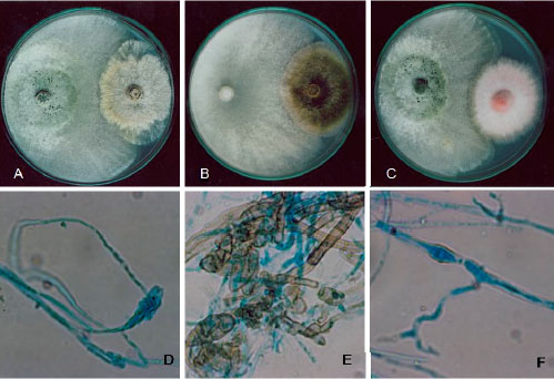 Image for - Isolation of Cold Tolerant Antifungal Strains of Trichoderma  sp. From Glacial Sites of Indian Himalayan Region