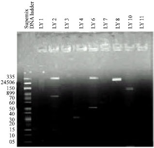 Image for - Antibiogram and Plasmid Profile Analysis of Isolated Escherichia coli from Broiler and Layer