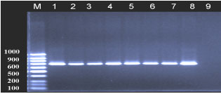 Image for - Detection of Diarrheagenic Escherichia coli Isolated Using Molecular Approaches