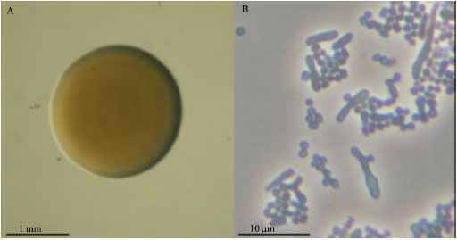Image for - Isolation and Characterization of 3-N-Trimethylamino-1-Propanol Degrading Arthrobacter sp. Strain E5