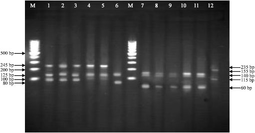 Image for - Application of PCR-Based Fingerprinting for Detection of Nontuberculous Mycobacteria among Patients Referred to Tuberculosis Reference Center of Khuzestan Province, Iran