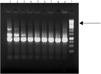 Image for - Construction of pcDNA/fimH Cassette as a DNA Vaccine Candidate Against Urinary Tract Infection and Evaluation of fimH Transcripts in COS7 Cell Line