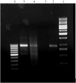 Image for - Construction of pcDNA/fimH Cassette as a DNA Vaccine Candidate Against Urinary Tract Infection and Evaluation of fimH Transcripts in COS7 Cell Line