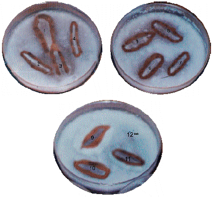 Image for - Antifungal Activity of Bacteriocins of Lactic Acid Bacteria from Some Nigerian Fermented Foods