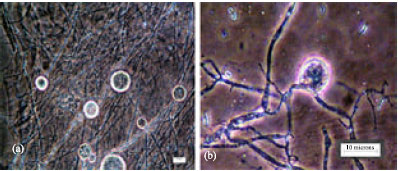 Image for - Morphological and Molecular Characterization of Polycentric Rumen Fungi Belonging to the Genus Orpinomyces Isolated from Indian Cattle and Buffaloes
