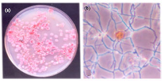 Image for - Anti-microbial Screening of Streptosporangium nondiastaticum TBG-75A20, Isolated from the Forest Soil of South India