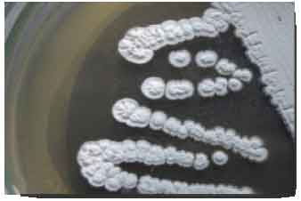 Image for - Screening of Marine Actinobacteria for Antimicrobial Compounds