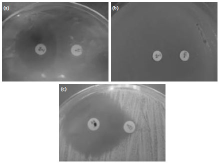Image for - Incidence of Macrolide-lincosamide-streptogramin-B Resistance Phenotypes of Methicillin Resistance Staphylococcus aureus and Methicillin Sensitive Staphylococcus aureus Among Animals in Saudi Arabia