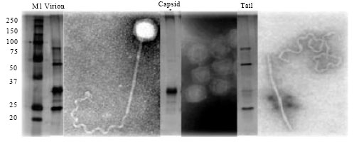 Image for - A Novel Bacteriophage Morphotype with a Ribbon-like Structure at the Tail Extremity