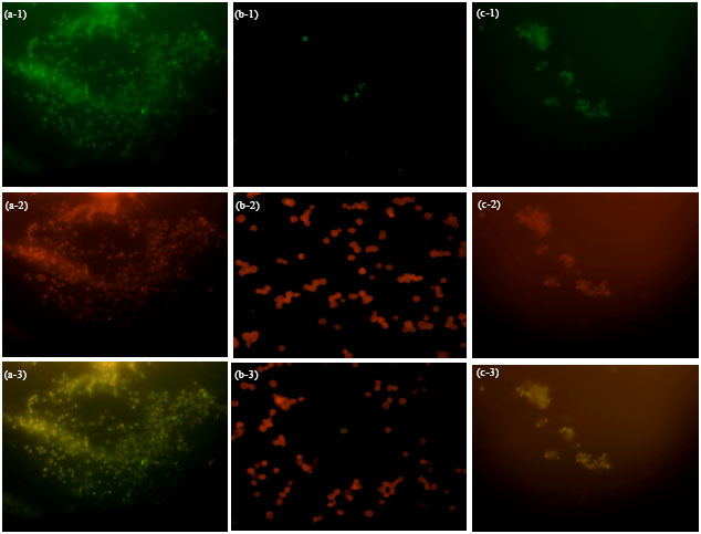 Image for - The Comparison in vitro Study of IgM Production Between Spleen and Peritoneal B-1a Cells