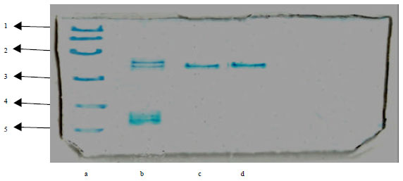 Image for - Purification and Characterization of Polygalacturonase using Isolated Bacillus  subtilis C4