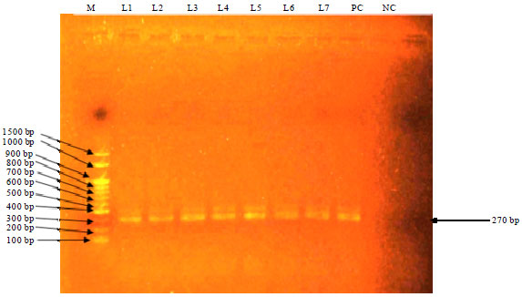 Image for - Detection of Staphylococcus aureus in Frozen Chicken Rinse through  Bacteriological and Nuc Gene Specific PCR Methods and their Drug Resistance  Patterns in Southern Chittagong, Bangladesh